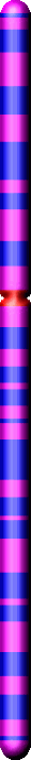 Chromozom 2 s mutací MSH6 genu